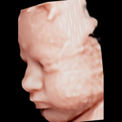 Ecografía original del rostro del bebé, ejemplo 02